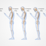 head-and-back-posture